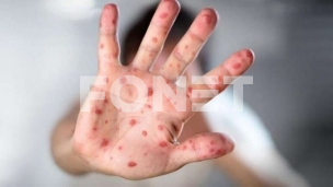 Epidemija u Brčkom 